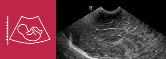 Ultrazvuková diagnostika